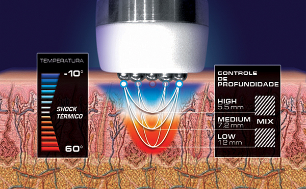 crio radiofrecventa