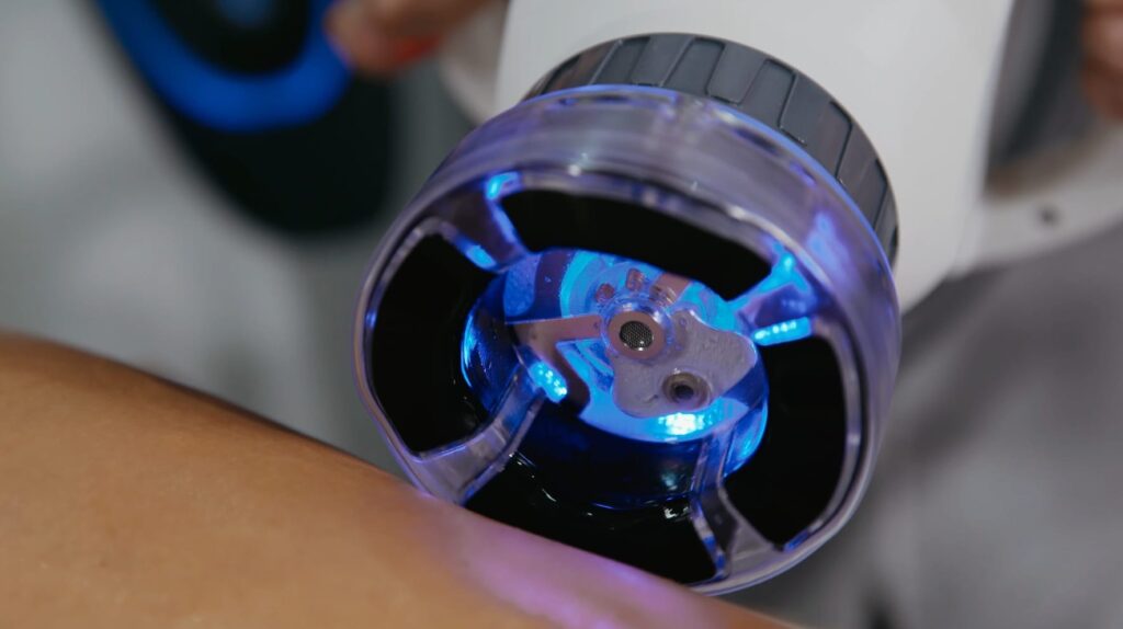 Revolvx - Tratament Anticelulitic Bucuresti